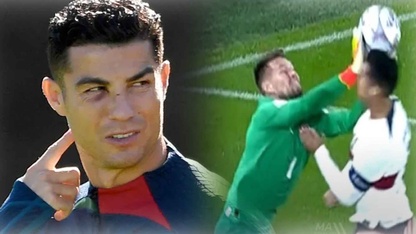 Mắt Ronaldo tím bầm sau chấn thương kinh hoàng ở trận gặp CH Séc